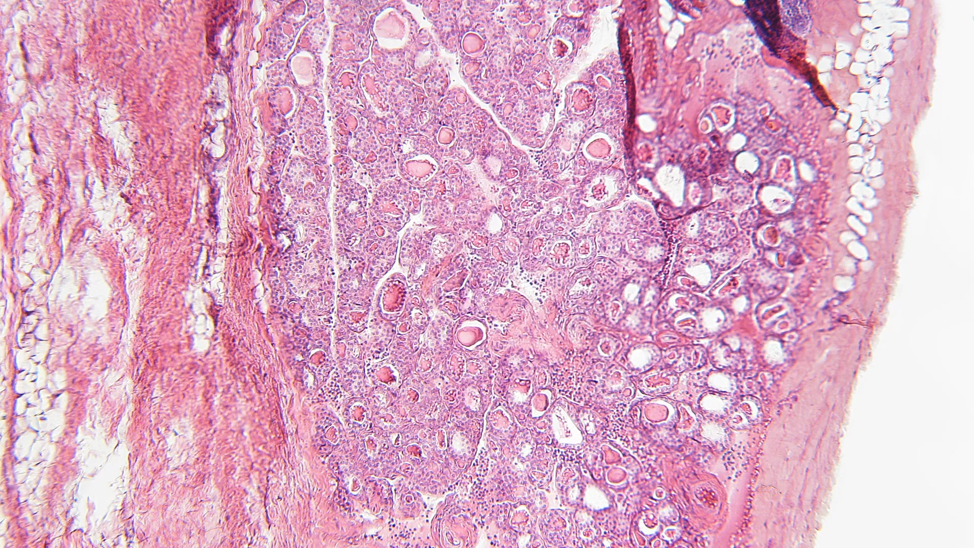 Metabole score voor visceraal vet en risico op perifeer arterieel vaatlijden bij hypertensie