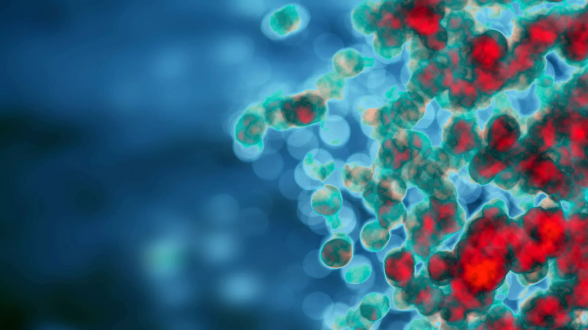 3-Hydroxystearinezuur bevordert cholesterolefflux en vermindert atherosclerose via ALKBH5/PAX-8/ABCA1