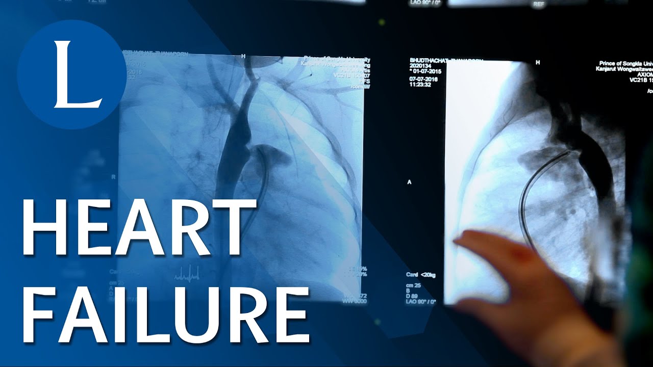 Lancet-serie: hartfalen is grotendeels te voorkomen